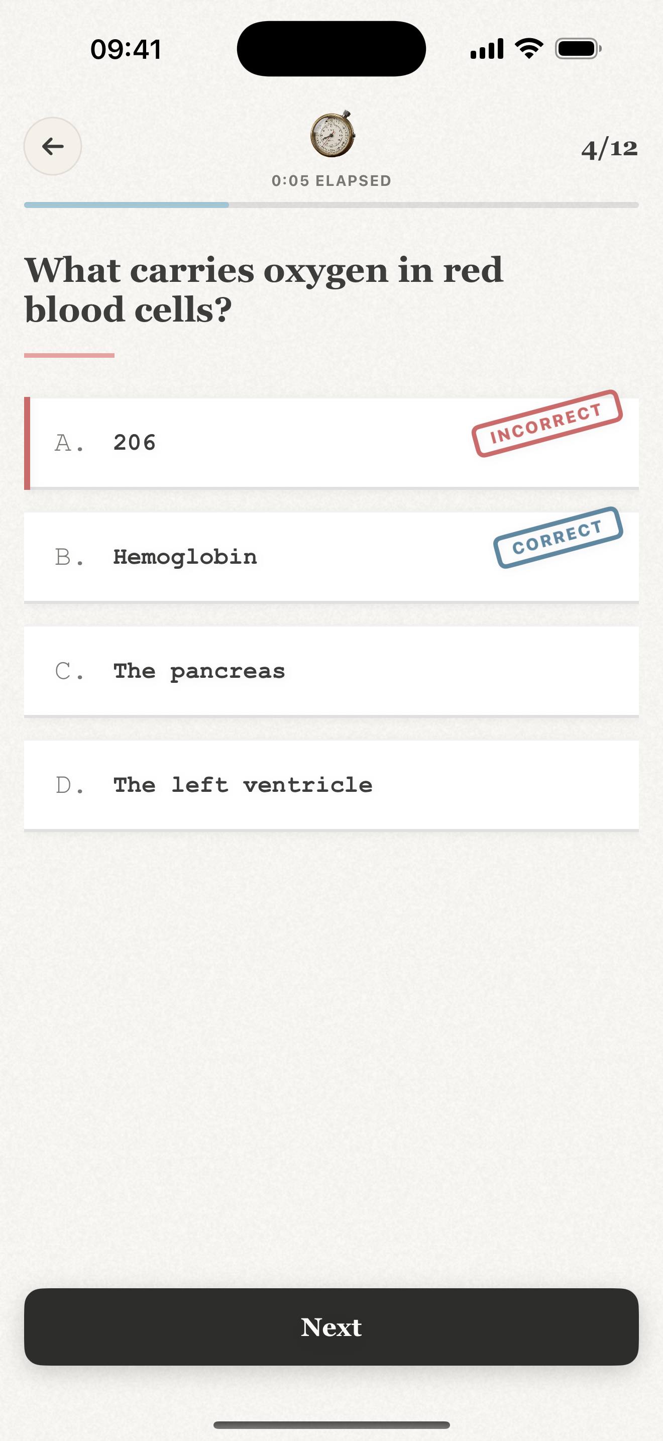 Repeto exam mode on iPhone: a multiple-choice question with instant marking